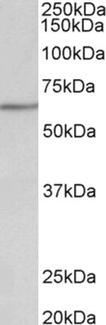 AKT2 Antibody in Western Blot (WB)