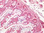 Cathepsin B Antibody in Immunohistochemistry (Paraffin) (IHC (P))