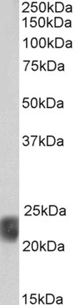 Caveolin 1 Antibody in Western Blot (WB)