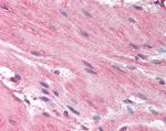 HRH1 Antibody in Immunohistochemistry (Paraffin) (IHC (P))