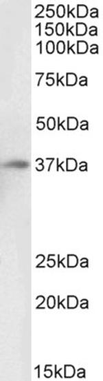 DARC Antibody in Western Blot (WB)