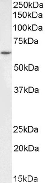 PLK1 Antibody in Western Blot (WB)