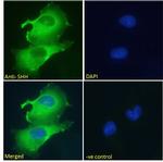 SHH Antibody in Immunocytochemistry (ICC/IF)