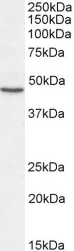 SHH Antibody in Western Blot (WB)