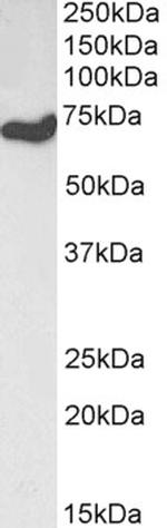 HDAC1 Antibody in Western Blot (WB)