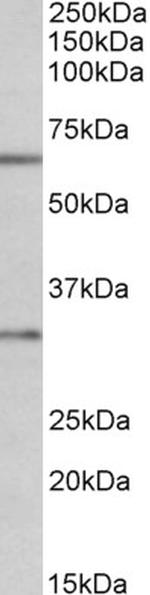 Caspase 3 Antibody in Western Blot (WB)