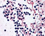 NLRP3 Antibody in Immunohistochemistry (Paraffin) (IHC (P))