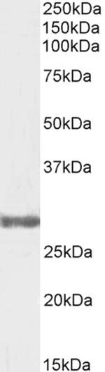 COMT Antibody in Western Blot (WB)