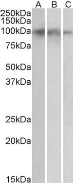 TrkB Antibody in Western Blot (WB)