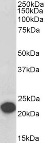 PEBP1 Antibody in Western Blot (WB)