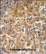 Ceruloplasmin Antibody in Immunohistochemistry (Paraffin) (IHC (P))