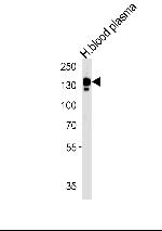 Ceruloplasmin Antibody in Western Blot (WB)