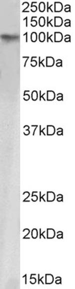 TRIM28 Antibody in Western Blot (WB)