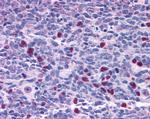 NAT10 Antibody in Immunohistochemistry (Paraffin) (IHC (P))