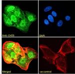 CHD5 Antibody in Immunocytochemistry (ICC/IF)