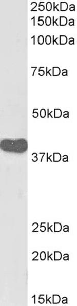 ILF2 Antibody in Western Blot (WB)