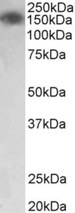 MYLK Antibody in Western Blot (WB)