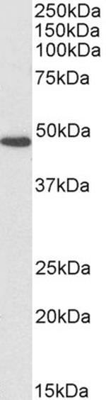 Fumarase Antibody in Western Blot (WB)