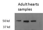 THRB Antibody in Western Blot (WB)