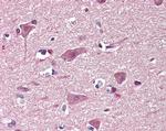 CHD7 Antibody in Immunohistochemistry (Paraffin) (IHC (P))