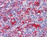 RIG-I Antibody in Immunohistochemistry (Paraffin) (IHC (P))