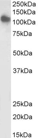 SLC12A6 Antibody in Western Blot (WB)