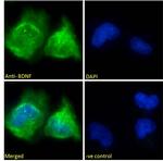 BDNF Antibody in Immunocytochemistry (ICC/IF)