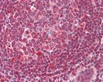 ERCC1 Antibody in Immunohistochemistry (Paraffin) (IHC (P))