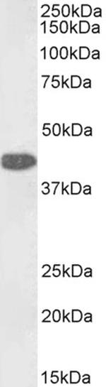 GOT1 Antibody in Western Blot (WB)