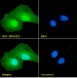 EPB41L5 Antibody in Immunocytochemistry (ICC/IF)