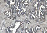 CEP290 Antibody in Immunohistochemistry (Paraffin) (IHC (P))