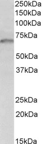 GRB10 Antibody in Western Blot (WB)