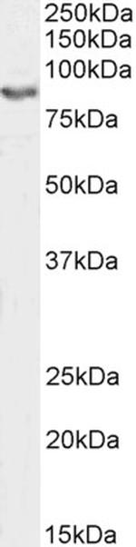 GluR4 Antibody in Western Blot (WB)