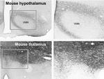 VGLUT1 Antibody in Immunohistochemistry (Paraffin) (IHC (P))