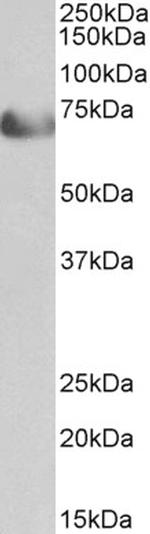 TCF4 Antibody in Western Blot (WB)