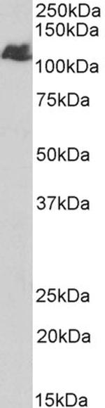 BMPR2 Antibody in Western Blot (WB)