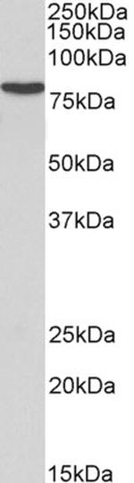 RSK3 Antibody in Western Blot (WB)