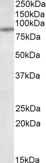 TAP1 Antibody in Western Blot (WB)