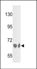 Complement Factor B Antibody in Western Blot (WB)