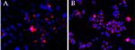 CEP290 Antibody in Immunocytochemistry (ICC/IF)