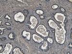 ROR1 Antibody in Immunohistochemistry (Paraffin) (IHC (P))