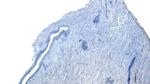 ROR1 Antibody in Immunohistochemistry (Paraffin) (IHC (P))