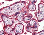 Thrombospondin 1 Antibody in Immunohistochemistry (Paraffin) (IHC (P))