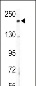 COL5A2 Antibody in Western Blot (WB)