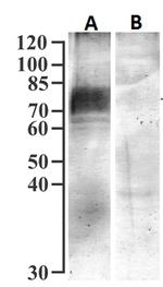 SGLT1 Antibody in Western Blot (WB)