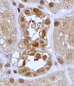 SGK1 Antibody in Immunohistochemistry (Paraffin) (IHC (P))