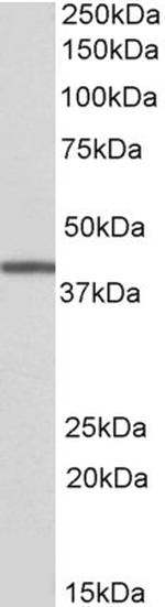 TRIB1 Antibody in Western Blot (WB)