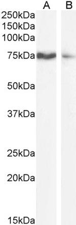 OATP8 Antibody in Western Blot (WB)