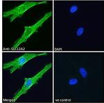 NKCC1 Antibody in Immunocytochemistry (ICC/IF)