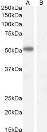 IKZF4 Antibody in Western Blot (WB)